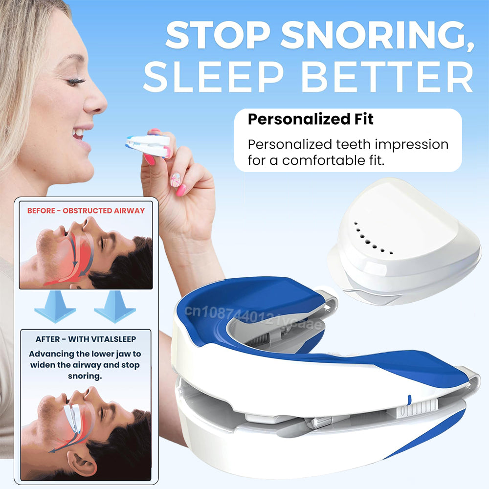 Curlaway SleepGuard Mouthpiece