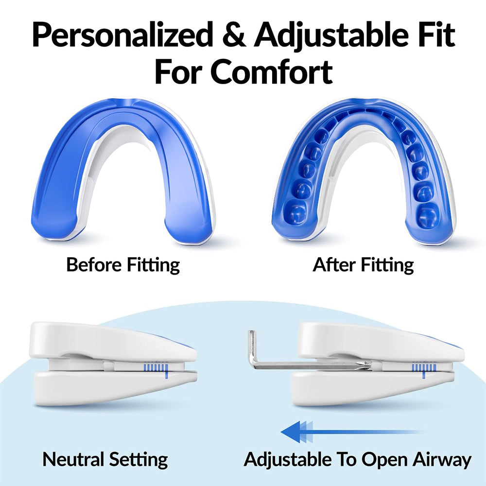 Curlaway SleepGuard Mouthpiece