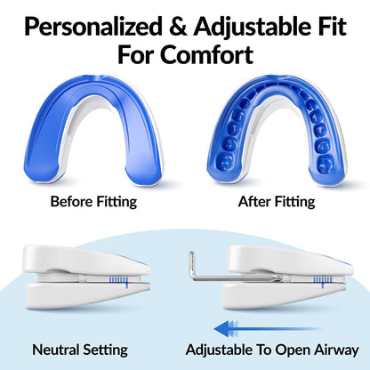 Curlaway SleepGuard Mouthpiece