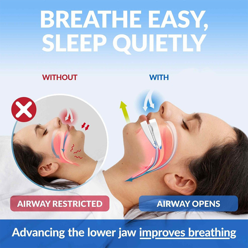 Curlaway SleepGuard Mouthpiece
