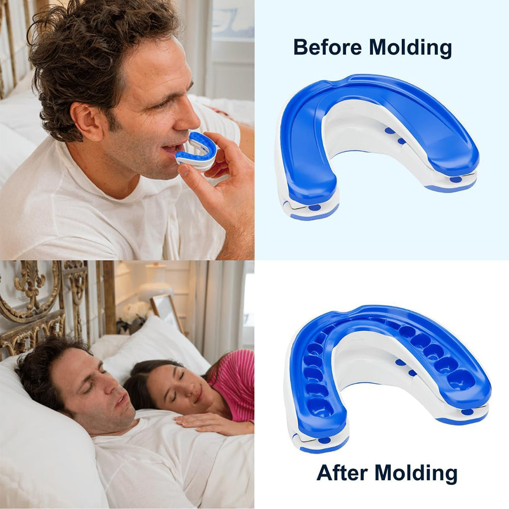 Curlaway SleepGuard Mouthpiece