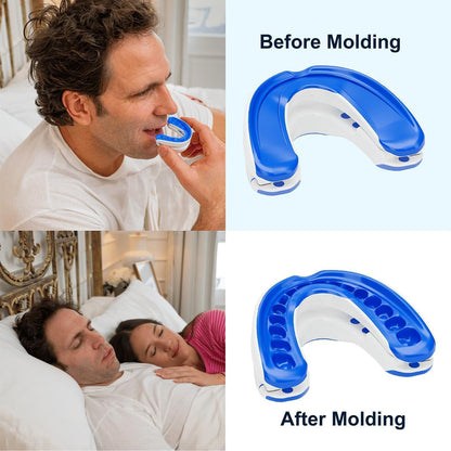 Curlaway SleepGuard Mouthpiece